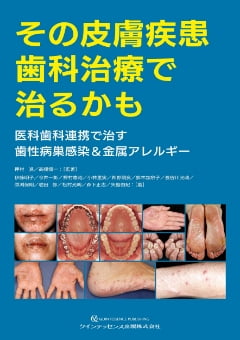 「その皮膚疾患歯科治療で治るかも 医科歯科連携で治す歯性病巣感染＆金属アレルギー」表紙
